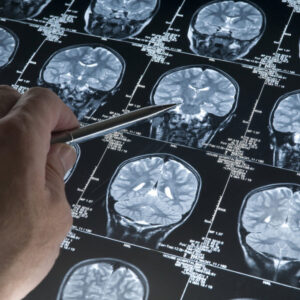 Un viaje al cerebro humano.