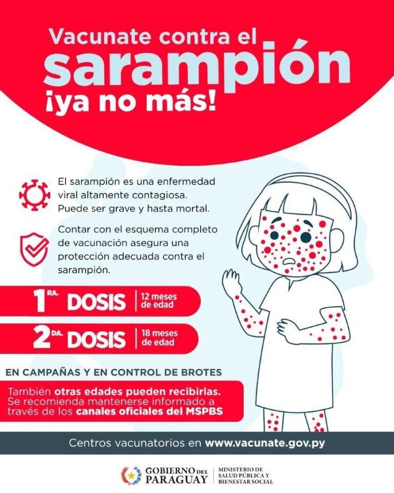 Sarampión en Paraguay: ¿hay nuevos casos?
