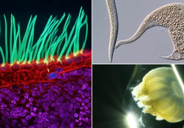 Dr. Ning Xu gana Nikon Small World 2026 con imágenes de cilias en PCD, destacando la belleza microscópica en la ciencia