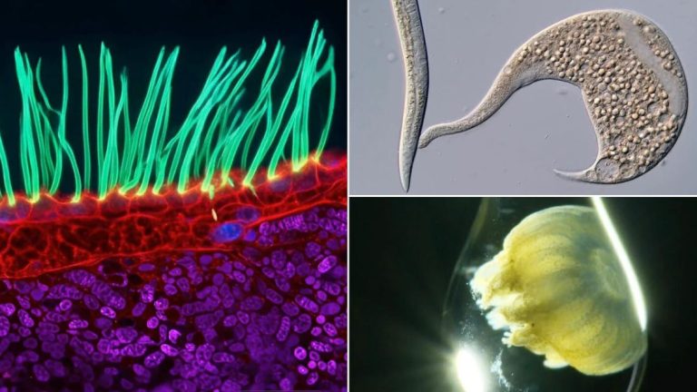 Dr. Ning Xu gana Nikon Small World 2026 con imágenes de cilias en PCD, destacando la belleza microscópica en la ciencia