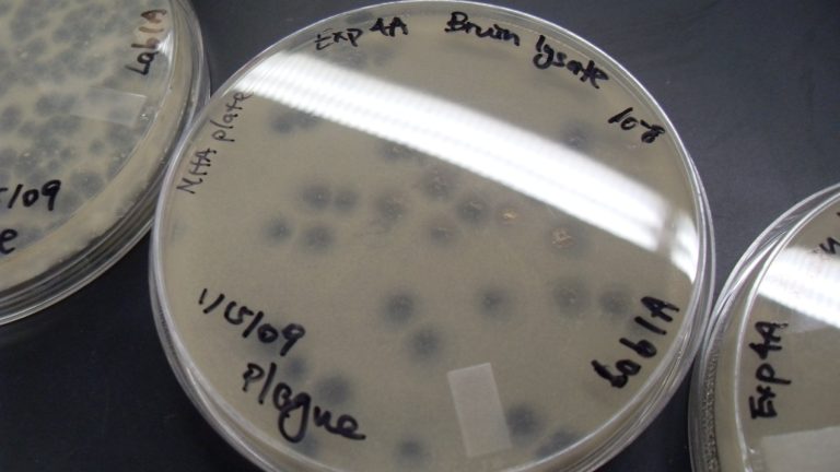 Los microbios del suelo eliminan 70 millones de toneladas de hidrógeno del aire cada año: científicos australianos aislaron la enzima Huc y la convirtieron en una batería que nunca hay que enchufar